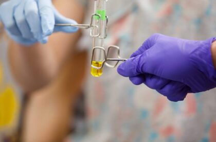 FJG-ALBION-2797-3-687x458